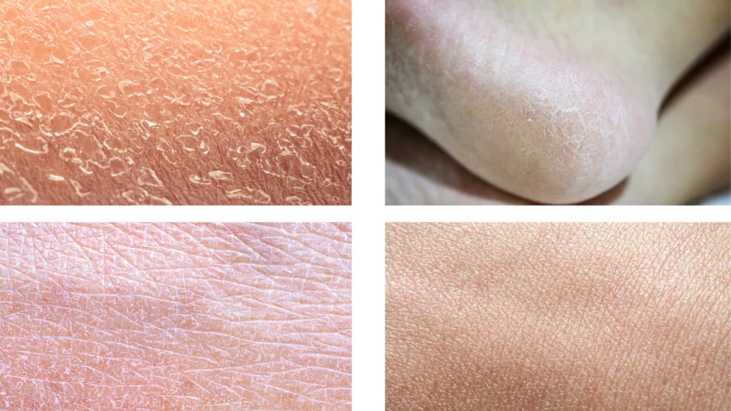 11 Migliori creme corpo idratanti per pelle secca: Guida Essenziale 2 Piel corporal seca