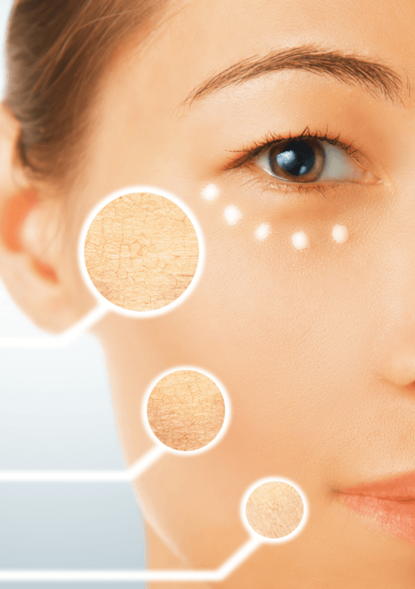 Pelle seca ?Confronto tra le migliori creme idratanti per la pelle secca e i loro benefici