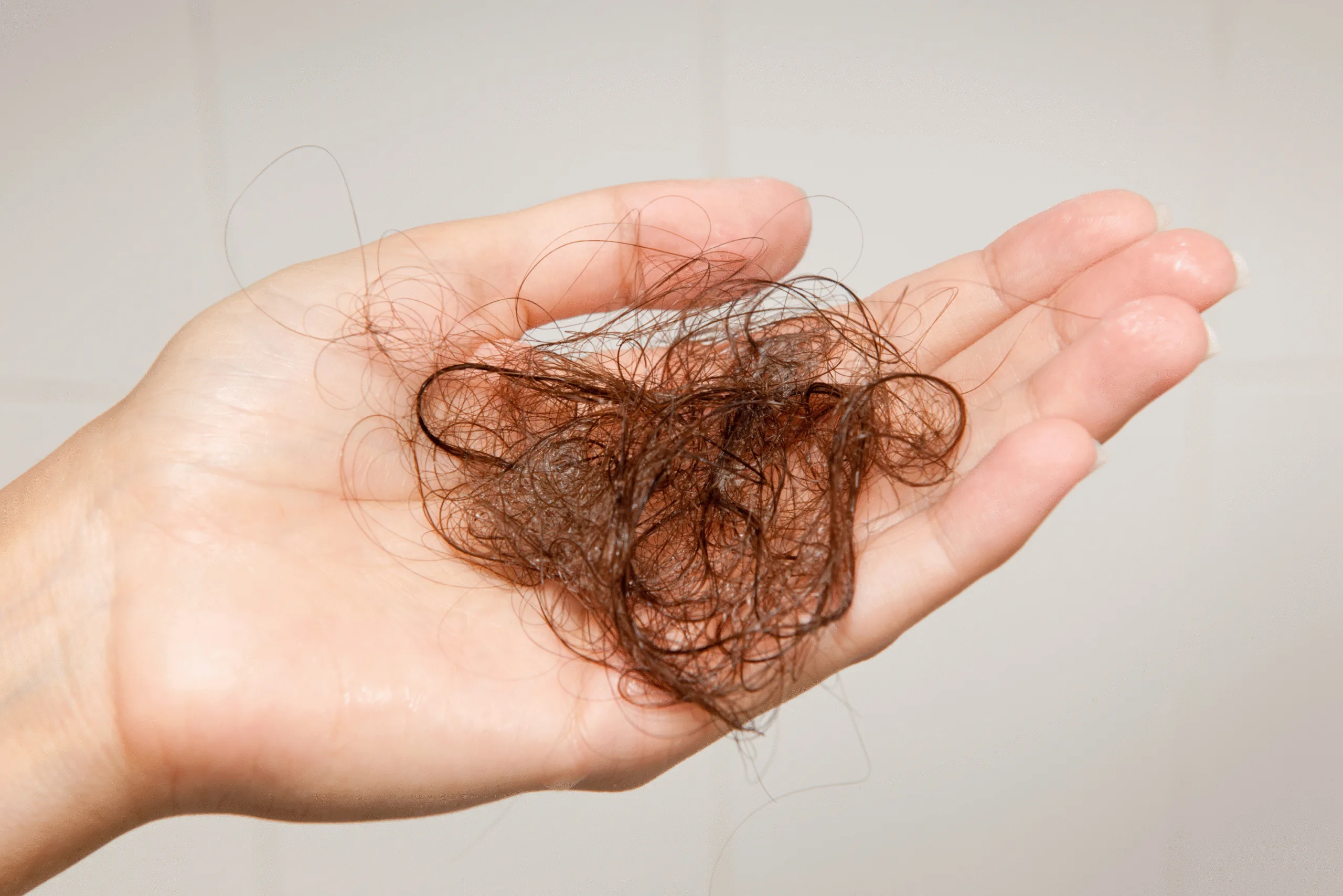 Caduta capelli scaled