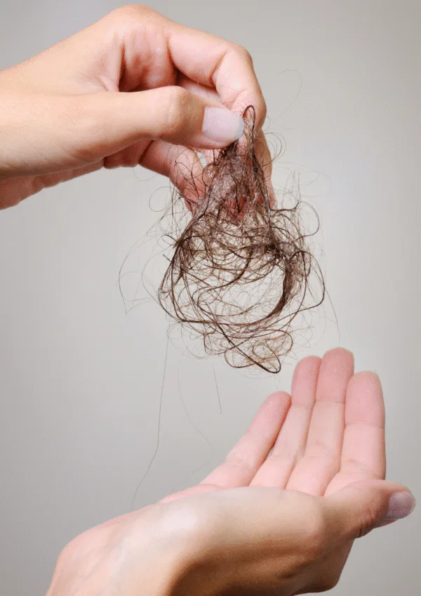 Caduta stagionale dei capelli